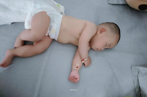 海拉尔六个月宝宝眼睛散光